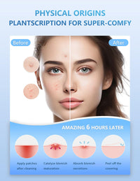 Pimple Patches for Face, 255 Pcs 5 Colors & 5 Sizes(8,10,12,14,16mm) Acne Patches Hydrocolloid Precise Matches Different Size, Cute Star Spot invisible Zit Covering, Absorbing Cover, Tea Tree
